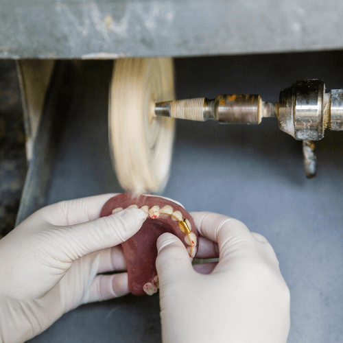 dental mold being shaved down.