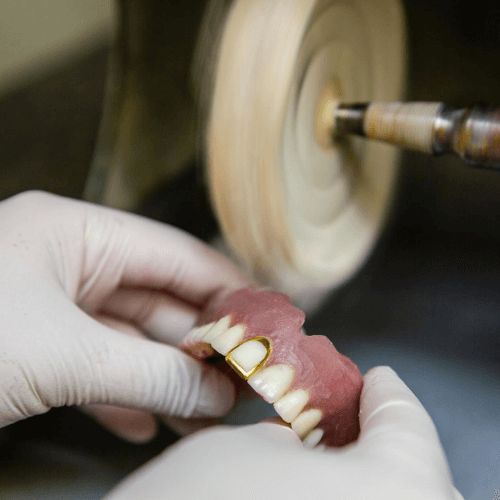 Denture being molded by a dental tool.