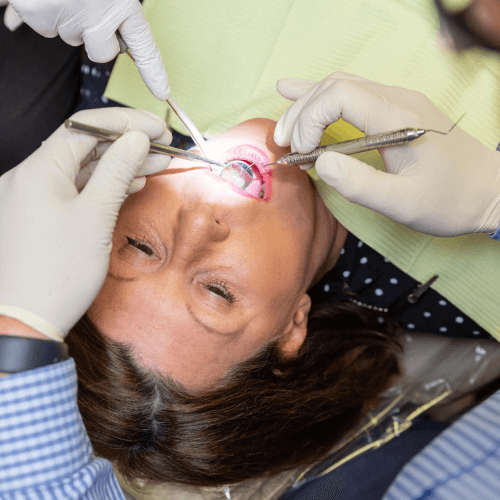 Dentist performing a dental procedure on a patient during treatment at a family dentistry office.