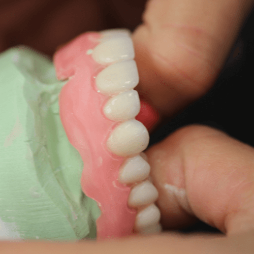 Close-up of dentures being shaped during custom denture fabrication in a dental lab.