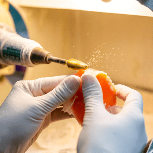 denture being shaved down