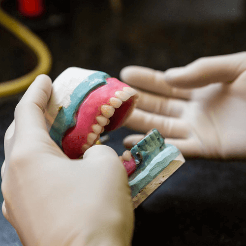 denture in dentists hand